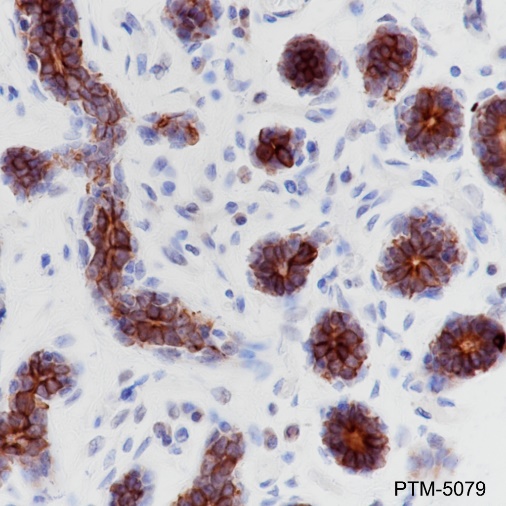Anti-Keratin 6 Rabbit mAb