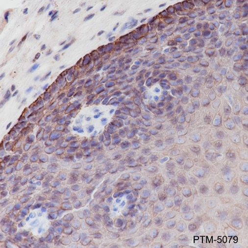 Anti-Keratin 6 Rabbit mAb