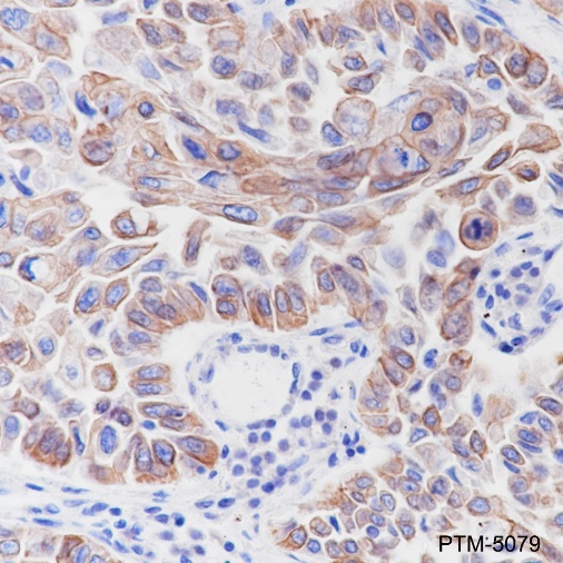 Anti-Keratin 6 Rabbit mAb