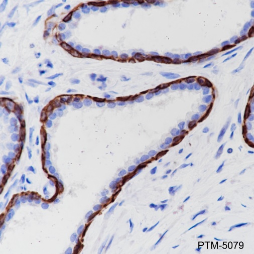 Anti-Keratin 6 Rabbit mAb
