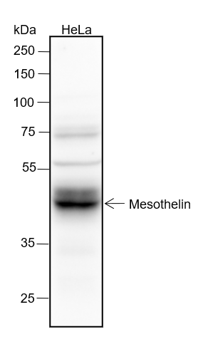 Anti-Mesothelin Rabbit mAb