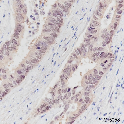 Anti-CDX2 Rabbit mAb