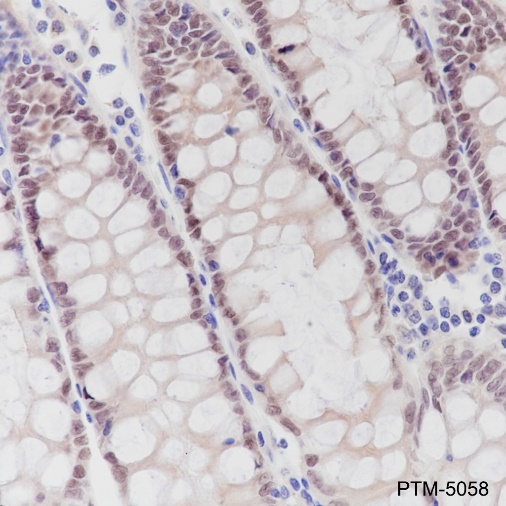 Anti-CDX2 Rabbit mAb