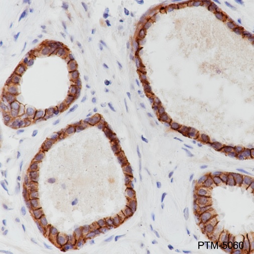 Anti-E-Cadherin Rabbit mAb