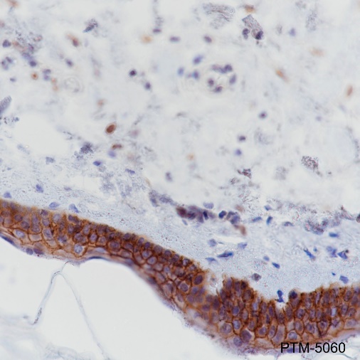 Anti-E-Cadherin Rabbit mAb