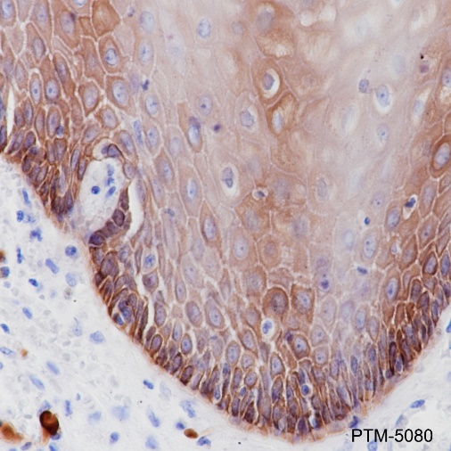 Anti-Keratin 5 Rabbit mAb