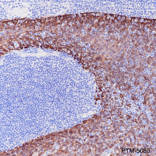 Anti-Keratin 5 Rabbit mAb