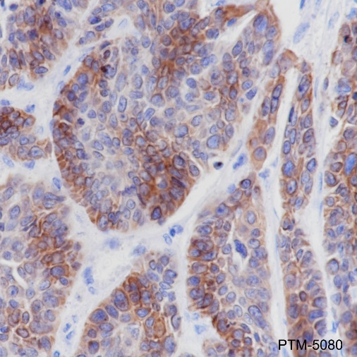 Anti-Keratin 5 Rabbit mAb