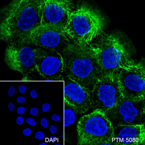 Anti-Keratin 5 Rabbit mAb