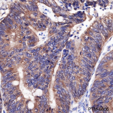 Anti-Calretinin Rabbit pAb