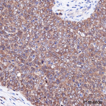 Anti-Calretinin Rabbit pAb