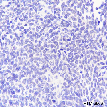 Anti-Calretinin Rabbit pAb