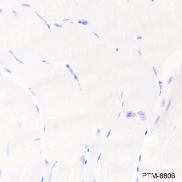 Anti-Calretinin Rabbit pAb