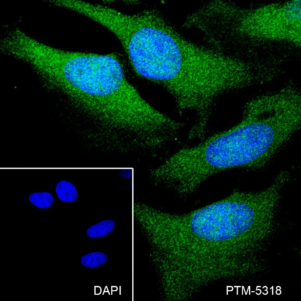 Anti-STAT5b Mouse mAb