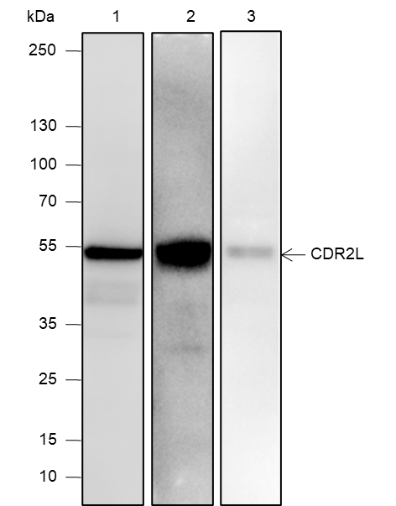 Anti-CDR2L Mouse mAb