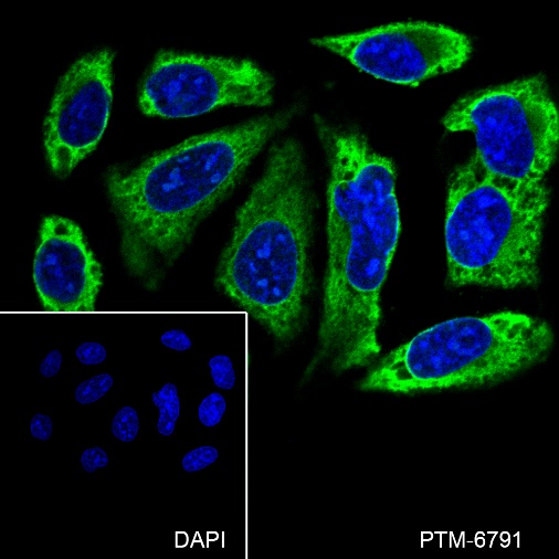 Anti-CDR2L Mouse mAb