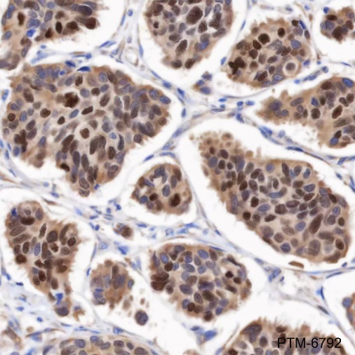Anti-Estrogen Receptor alpha Rabbit mAb