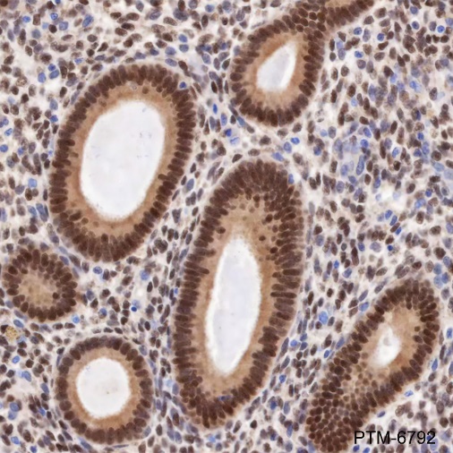 Anti-Estrogen Receptor alpha Rabbit mAb