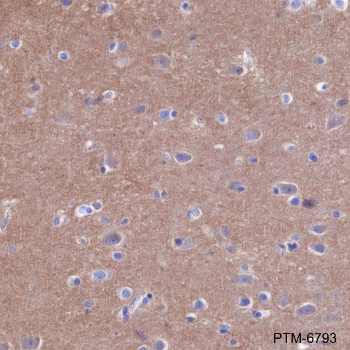 Anti-Bcr Rabbit mAb