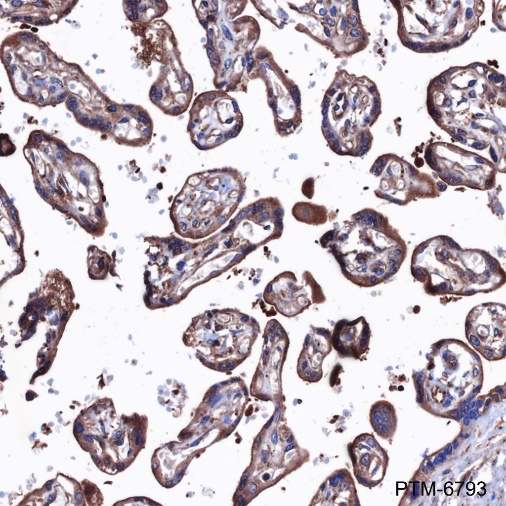 Anti-Bcr Rabbit mAb