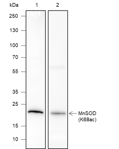 Anti-Acetyl-SOD2 (Lys68) Rabbit mAb