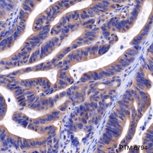 Anti-Acetyl-SOD2 (Lys68) Rabbit mAb