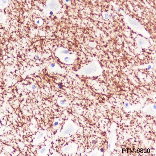 Anti-Myelin Basic Protein Rabbit pAb
