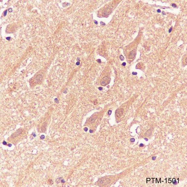 Anti-Methacryllysine Mouse mAb