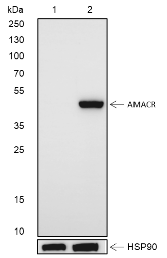 Anti-AMACR Rabbit mAb