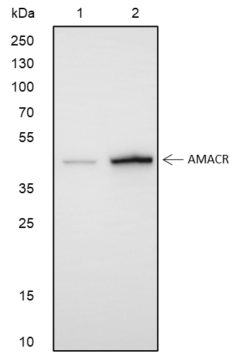 Anti-AMACR Rabbit mAb