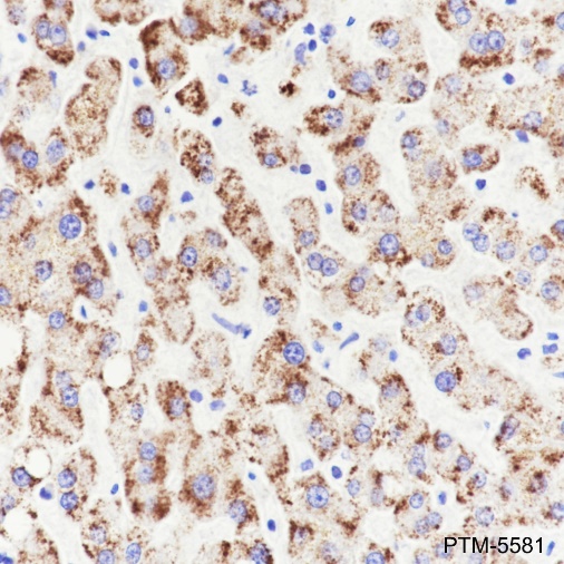 Anti-AMACR Rabbit mAb