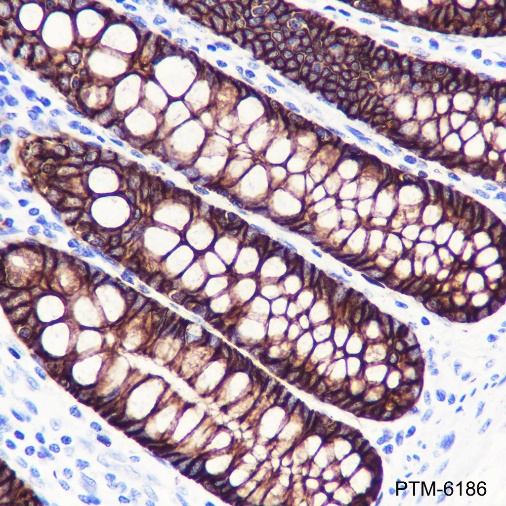 Anti-GPA33 Rabbit mAb