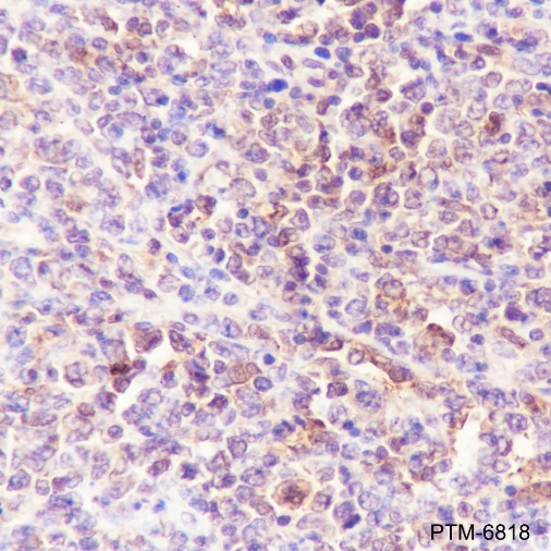 Anti-Galectin-9 Rabbit pAb