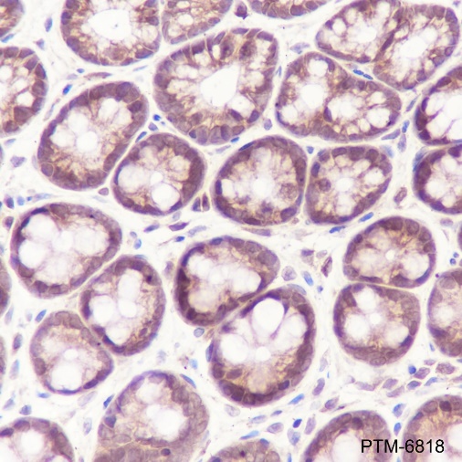 Anti-Galectin-9 Rabbit pAb