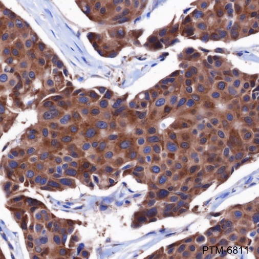 Anti-ALDH9A1 Mouse mAb
