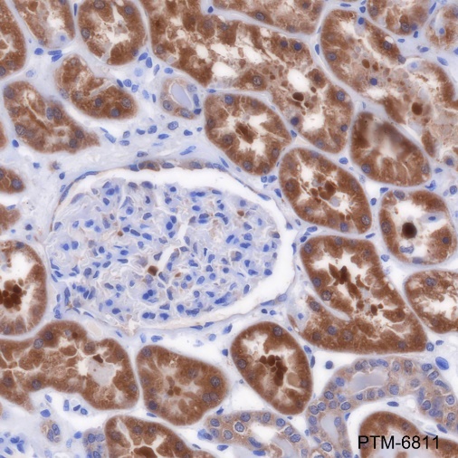 Anti-ALDH9A1 Mouse mAb