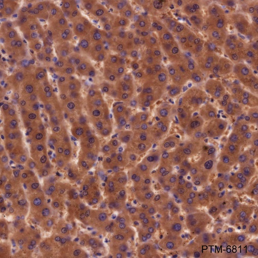 Anti-ALDH9A1 Mouse mAb