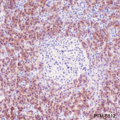 Anti-Asparagine Synthetase Mouse mAb