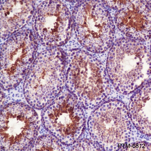 Anti-Asparagine Synthetase Mouse mAb
