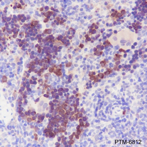 Anti-Asparagine Synthetase Mouse mAb