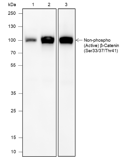 Anti-non-Phospho (Active) beta Catenin (Ser33/37/Thr41) Rabbit mAb
