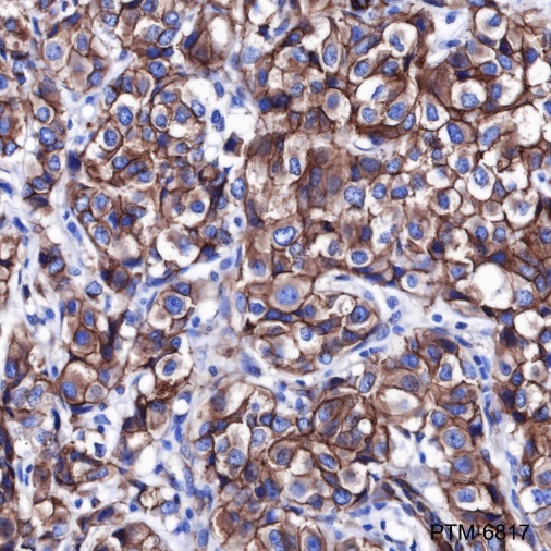 Anti-non-Phospho (Active) beta Catenin (Ser33/37/Thr41) Rabbit mAb
