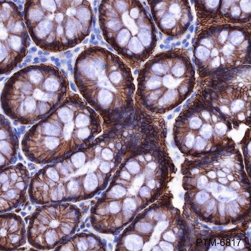 Anti-non-Phospho (Active) beta Catenin (Ser33/37/Thr41) Rabbit mAb