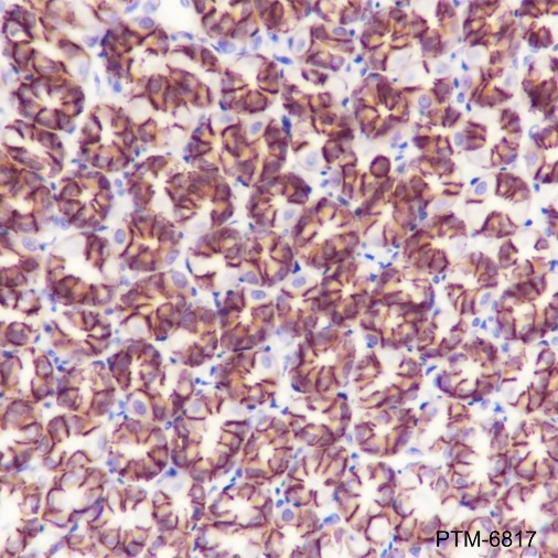 Anti-non-Phospho (Active) beta Catenin (Ser33/37/Thr41) Rabbit mAb