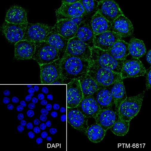Anti-non-Phospho (Active) beta Catenin (Ser33/37/Thr41) Rabbit mAb