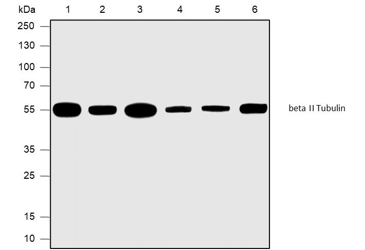 Anti-beta II Tubulin Rabbit mAb