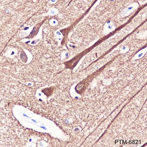 Anti-beta II Tubulin Rabbit mAb