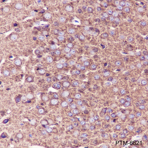 Anti-beta II Tubulin Rabbit mAb