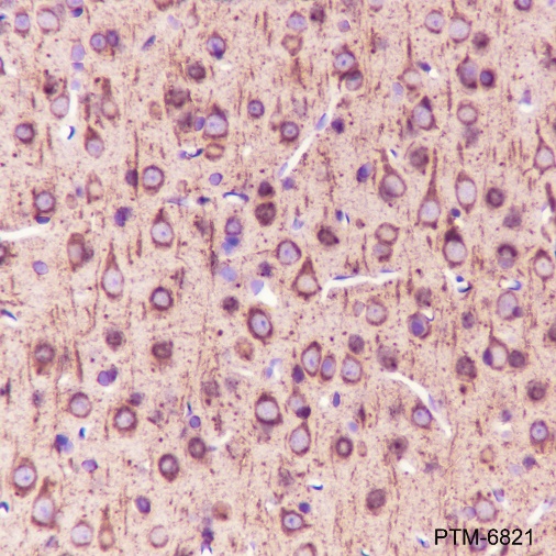 Anti-beta II Tubulin Rabbit mAb