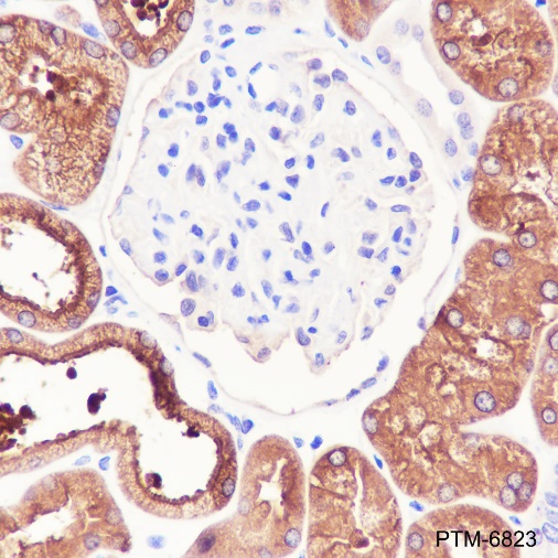 Anti-58K Golgi Protein Rabbit pAb